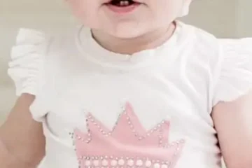 Bebê usando órtese craniana (capacete) rosa
