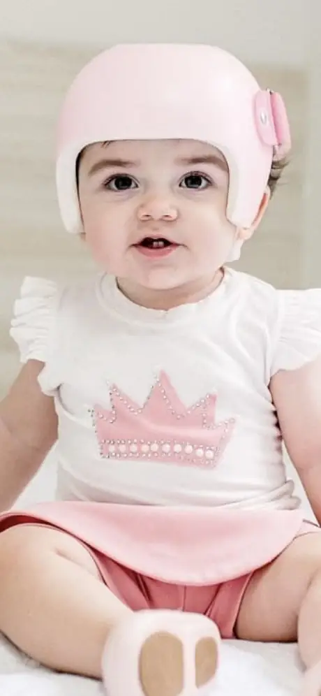 Bebê usando órtese craniana (capacete) rosa